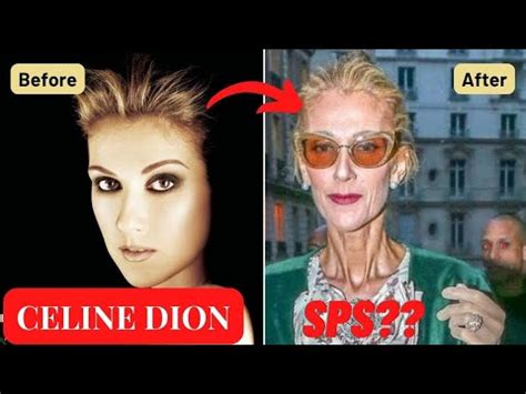 how long has celine been sick|is celine dion sick.